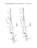 Methods And Devices For Treating Pelvic Conditions diagram and image