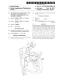 APPARATUS FOR SAFE PERFORMANCE OF TRANSSEPTAL TECHNIQUE AND PLACEMENT AND     POSITIONING OF AN ABLATION CATHETER diagram and image