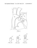 APPARATUS FOR SAFE PERFORMANCE OF TRANSSEPTAL TECHNIQUE AND PLACEMENT AND     POSITIONING OF AN ABLATION CATHETER diagram and image