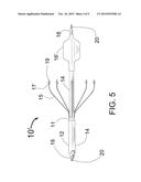 METHODS OF ABLATING TISSUE USING A CATHETER INJECTION SYSTEM diagram and image