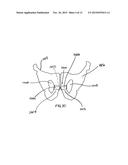 Implantable sling for the treatment of incontinence and method of using     the same diagram and image