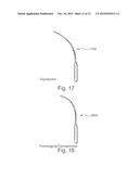 Implantable sling for the treatment of incontinence and method of using     the same diagram and image