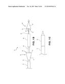 METHOD OF ISOLATING THE CEREBRAL CIRCULATION DURING A CARDIAC PROCEDURE diagram and image