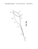 METHOD OF ISOLATING THE CEREBRAL CIRCULATION DURING A CARDIAC PROCEDURE diagram and image