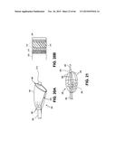 METHOD OF ISOLATING THE CEREBRAL CIRCULATION DURING A CARDIAC PROCEDURE diagram and image