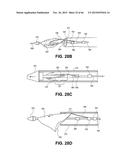 METHOD OF ISOLATING THE CEREBRAL CIRCULATION DURING A CARDIAC PROCEDURE diagram and image