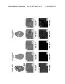 TWO STAGE CELLULARIZATION STRATEGY FOR THE FABRICATION OF BIOARTIFICIAL     HEARTS diagram and image