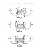 Cortical loop fixation system for ligament and bone reconstruction diagram and image