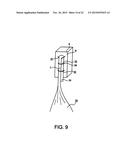 Cortical loop fixation system for ligament and bone reconstruction diagram and image