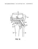 Cortical loop fixation system for ligament and bone reconstruction diagram and image