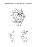 PROSTHETIC HEART VALVE DEVICES, PROSTHETIC MITRAL VALVES AND ASSOCIATED     SYSTEMS AND METHODS diagram and image