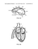 PROSTHETIC HEART VALVE DEVICES, PROSTHETIC MITRAL VALVES AND ASSOCIATED     SYSTEMS AND METHODS diagram and image