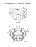 PROSTHETIC HEART VALVE DEVICES, PROSTHETIC MITRAL VALVES AND ASSOCIATED     SYSTEMS AND METHODS diagram and image