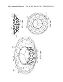 PROSTHETIC HEART VALVE DEVICES, PROSTHETIC MITRAL VALVES AND ASSOCIATED     SYSTEMS AND METHODS diagram and image