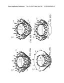 PROSTHETIC HEART VALVE DEVICES, PROSTHETIC MITRAL VALVES AND ASSOCIATED     SYSTEMS AND METHODS diagram and image