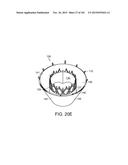 PROSTHETIC HEART VALVE DEVICES, PROSTHETIC MITRAL VALVES AND ASSOCIATED     SYSTEMS AND METHODS diagram and image