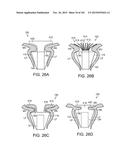 PROSTHETIC HEART VALVE DEVICES, PROSTHETIC MITRAL VALVES AND ASSOCIATED     SYSTEMS AND METHODS diagram and image