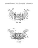 PROSTHETIC HEART VALVE DEVICES, PROSTHETIC MITRAL VALVES AND ASSOCIATED     SYSTEMS AND METHODS diagram and image