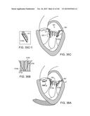 PROSTHETIC HEART VALVE DEVICES, PROSTHETIC MITRAL VALVES AND ASSOCIATED     SYSTEMS AND METHODS diagram and image