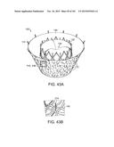 PROSTHETIC HEART VALVE DEVICES, PROSTHETIC MITRAL VALVES AND ASSOCIATED     SYSTEMS AND METHODS diagram and image