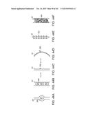 PROSTHETIC HEART VALVE DEVICES, PROSTHETIC MITRAL VALVES AND ASSOCIATED     SYSTEMS AND METHODS diagram and image