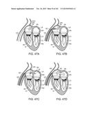 PROSTHETIC HEART VALVE DEVICES, PROSTHETIC MITRAL VALVES AND ASSOCIATED     SYSTEMS AND METHODS diagram and image