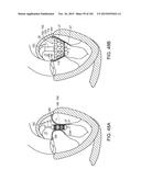 PROSTHETIC HEART VALVE DEVICES, PROSTHETIC MITRAL VALVES AND ASSOCIATED     SYSTEMS AND METHODS diagram and image