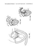 PROSTHETIC HEART VALVE DEVICES, PROSTHETIC MITRAL VALVES AND ASSOCIATED     SYSTEMS AND METHODS diagram and image