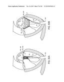 PROSTHETIC HEART VALVE DEVICES, PROSTHETIC MITRAL VALVES AND ASSOCIATED     SYSTEMS AND METHODS diagram and image