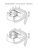 PROSTHETIC HEART VALVE DEVICES, PROSTHETIC MITRAL VALVES AND ASSOCIATED     SYSTEMS AND METHODS diagram and image