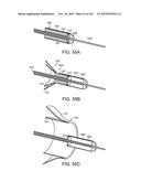 PROSTHETIC HEART VALVE DEVICES, PROSTHETIC MITRAL VALVES AND ASSOCIATED     SYSTEMS AND METHODS diagram and image