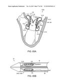 PROSTHETIC HEART VALVE DEVICES, PROSTHETIC MITRAL VALVES AND ASSOCIATED     SYSTEMS AND METHODS diagram and image