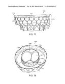 PROSTHETIC HEART VALVE DEVICES, PROSTHETIC MITRAL VALVES AND ASSOCIATED     SYSTEMS AND METHODS diagram and image