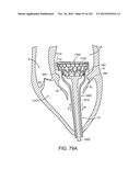 PROSTHETIC HEART VALVE DEVICES, PROSTHETIC MITRAL VALVES AND ASSOCIATED     SYSTEMS AND METHODS diagram and image