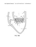 PROSTHETIC HEART VALVE DEVICES, PROSTHETIC MITRAL VALVES AND ASSOCIATED     SYSTEMS AND METHODS diagram and image