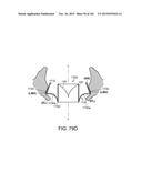 PROSTHETIC HEART VALVE DEVICES, PROSTHETIC MITRAL VALVES AND ASSOCIATED     SYSTEMS AND METHODS diagram and image