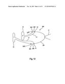 APPARATUS AND SET FOR FOLDING OR UNFOLDING A MEDICAL IMPLANT COMPRISING A     CLAMPING MECHANISM, IMPLANT AND METHOD diagram and image