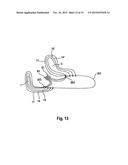 APPARATUS AND SET FOR FOLDING OR UNFOLDING A MEDICAL IMPLANT COMPRISING A     CLAMPING MECHANISM, IMPLANT AND METHOD diagram and image