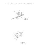 ARRANGEMENT AND IMPLANT FOR REPLACING SURFACES THAT ARE SUBJECT TO     STRESSES diagram and image