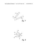 ARRANGEMENT AND IMPLANT FOR REPLACING SURFACES THAT ARE SUBJECT TO     STRESSES diagram and image