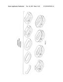 Additive and Subtractive Manufacturing Process for Producing Implants with     Homogeneous Body Substantially Free of Pores and Inclusions diagram and image