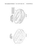 Additive and Subtractive Manufacturing Process for Producing Implants with     Homogeneous Body Substantially Free of Pores and Inclusions diagram and image