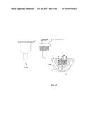 METHOD FOR MANUFACTURING A PROSTHETIC HIP ACETABULUM diagram and image