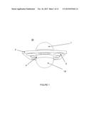 Elastomeric Artificial Joints and Intervertebral Prosthesis Systems diagram and image