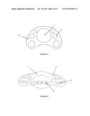 Elastomeric Artificial Joints and Intervertebral Prosthesis Systems diagram and image