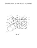 EXPANDABLE SPINAL IMPLANT SYSTEM AND METHOD diagram and image