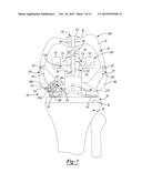 Knee Sizing And Balancing Instrument diagram and image