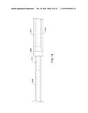 STENT DELIVERY SYSTEM diagram and image