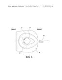 PATELLOFEMORAL DEVICE AND METHOD FOR USING THE SAME diagram and image