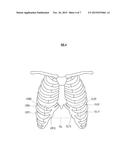 MOTION ASSIST APPARATUS diagram and image